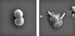 抗生物質が効かないスーパーバグを「物理的に」液体金属で切り裂いて破壊する研究　人間に害は？の画像 3/4