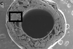 重度の神経損傷でもポリマーとタンパク質で治療できる技術が開発されるの画像 2/3