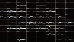 盲目の人の脳に直接信号を送って視界を与える視覚インプラントが登場の画像 4/5