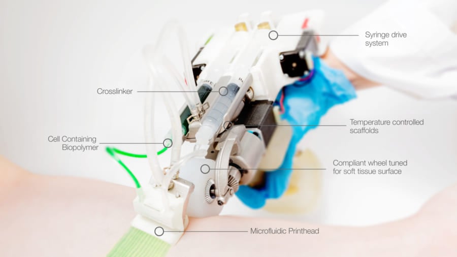 SFの世界。火傷を負った皮膚の上に「新しい皮膚を3Dプリント」する技術が開発