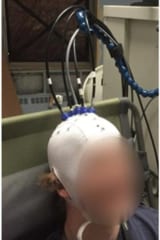 寝たきり患者の「意思」がわかる脳内スキャナーが開発されるの画像 2/4