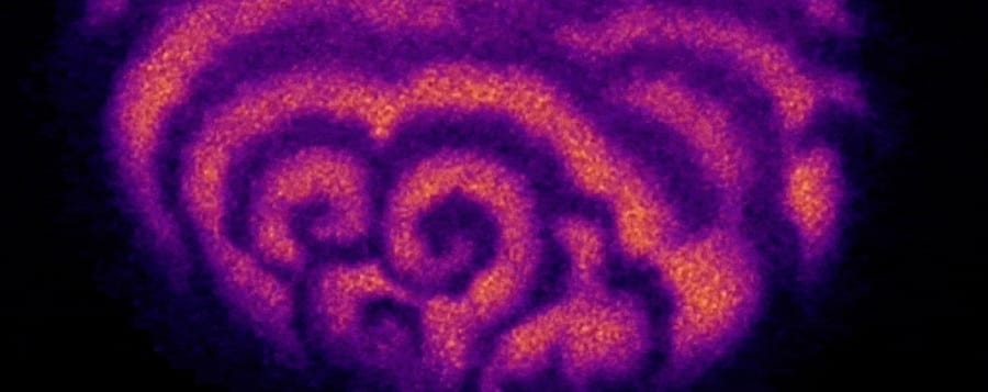 生命は神秘的な「渦（うず）」から始まることが判明