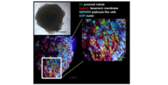 新型コロナの治療薬が完成間近！「疑似人体実験」で効果が確認されるの画像 5/5