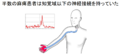 マヒ患者の運動能力と触覚が新技術で回復！触覚の情報コード化に成功の画像 6/7