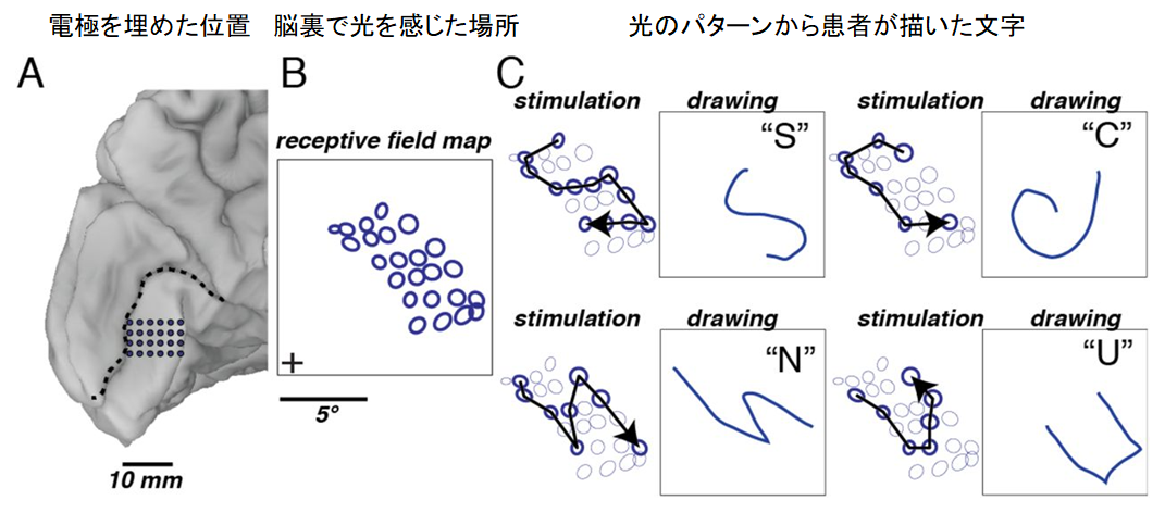 失明患者の脳に「電気で絵を描く」ことで文字が読めるようになる実験の画像 2/4