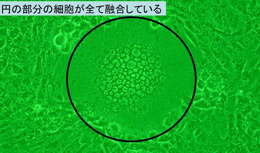 新型コロナウイルスの感染を完全に防ぐ抗体薬が作成されるの画像 2/3