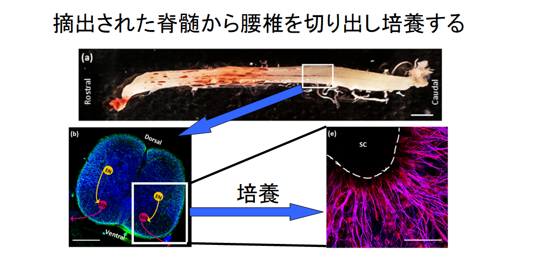 生きた筋肉と脊髄を接続したバイオボットの作成に成功！