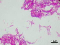 「BCGは新型コロナウイルスに効果なし」とする研究結果が発表されるの画像 2/3