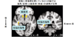 幸せの鍵は新しい場所！人の脳は「移動」を快楽と捉えていたの画像 3/4