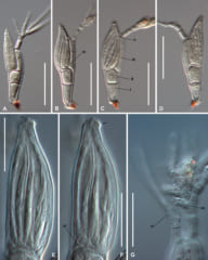 一人のツイッター投稿によって新種の寄生生物が発見される【虫注意】の画像 4/4