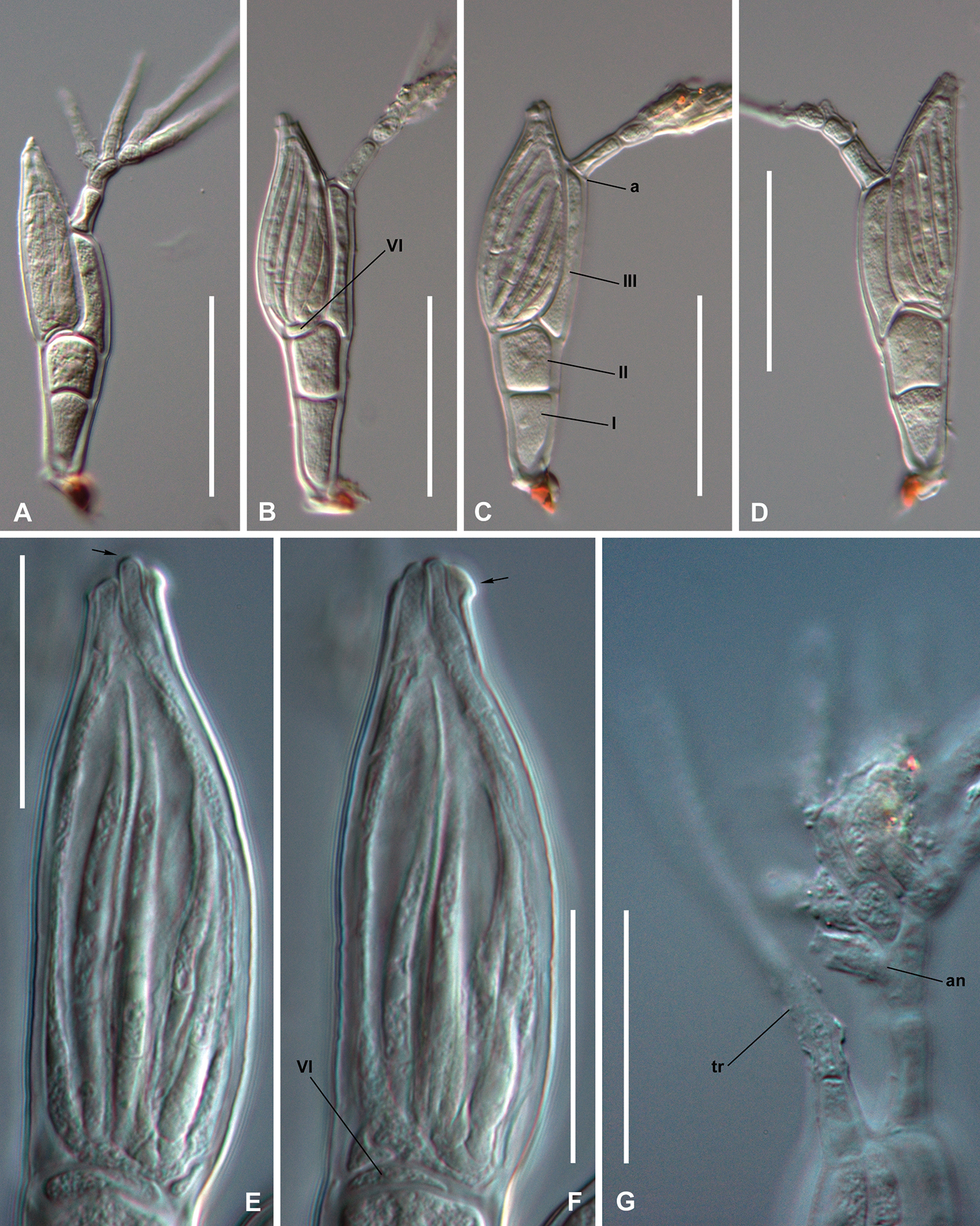 一人のツイッター投稿によって新種の寄生生物が発見される【虫注意】の画像 4/4