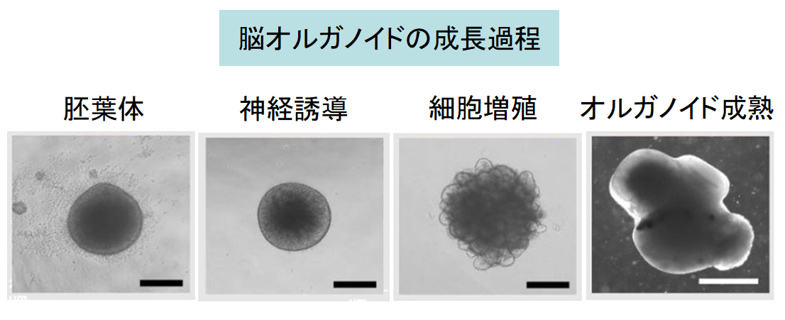ネアンデルタール人の遺伝子を組み込んだ人工培養脳（脳オルガノイド）の作成に成功！　の画像 3/3