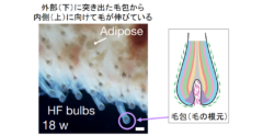 ハゲ治療に革命が！　iPS細胞から「髪が生えた皮膚」を作ることに成功の画像 3/6