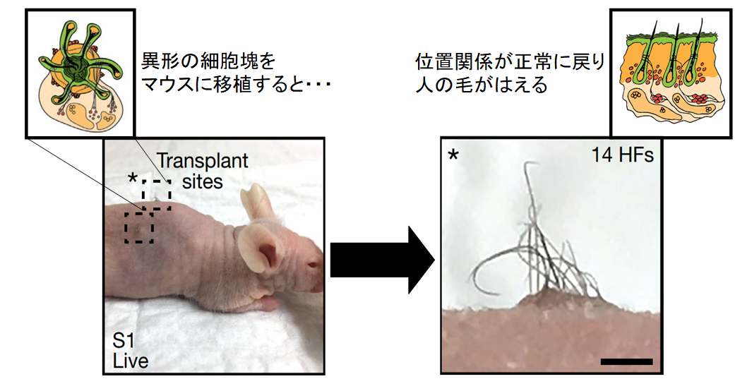 ハゲ治療に革命が！　iPS細胞から「髪が生えた皮膚」を作ることに成功の画像 4/6