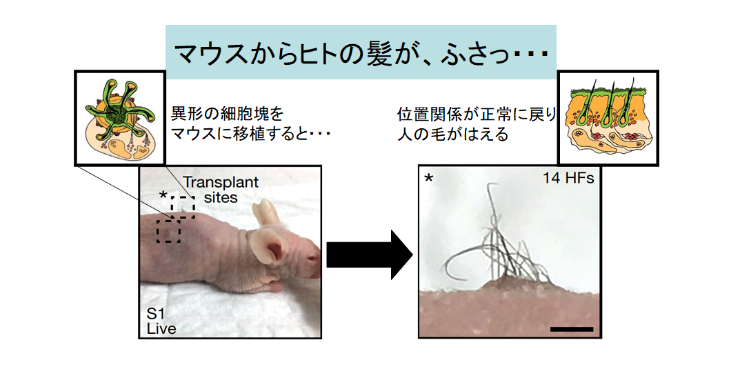 ハゲ治療に革命が！　iPS細胞から「髪が生えた皮膚」を作ることに成功