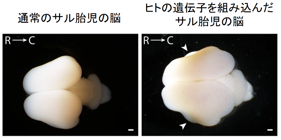 ヒトの脳を進化させた「知恵の実」遺伝子が、サルの脳を巨大化させると判明