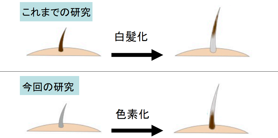 「白髪」が元に戻る！　髪はストレスの有無によって色を変えることが判明の画像 2/5