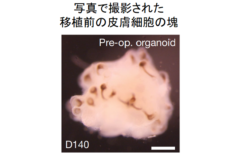 ハゲ治療に革命が！　iPS細胞から「髪が生えた皮膚」を作ることに成功の画像 5/6