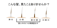 「白髪」が元に戻る！　髪はストレスの有無によって色を変えることが判明