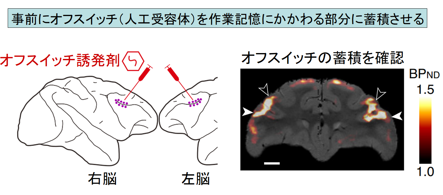 脳のスイッチをオフにして「記憶を削除する薬」が開発されるの画像 2/4