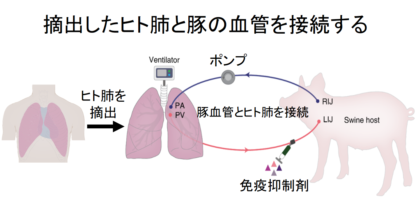 損傷したヒト肺を「豚に移植して回復させる」ことに成功！　生体だけに含まれる未知の物質の存在が示唆されるの画像 2/5