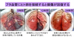 損傷したヒト肺を「豚に移植して回復させる」ことに成功！　生体だけに含まれる未知の物質の存在が示唆される