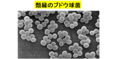 ワキガ臭がするのは1種類の「汗を食べる細菌」のせいだと判明！効果的な制汗剤が作られる？の画像 3/5