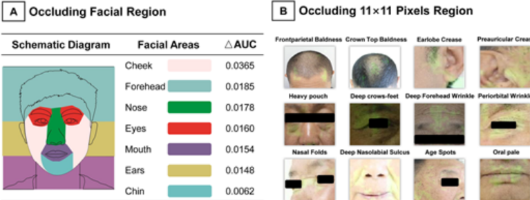 「自撮り写真」で心臓病を診断できるAIが開発されるの画像 2/3