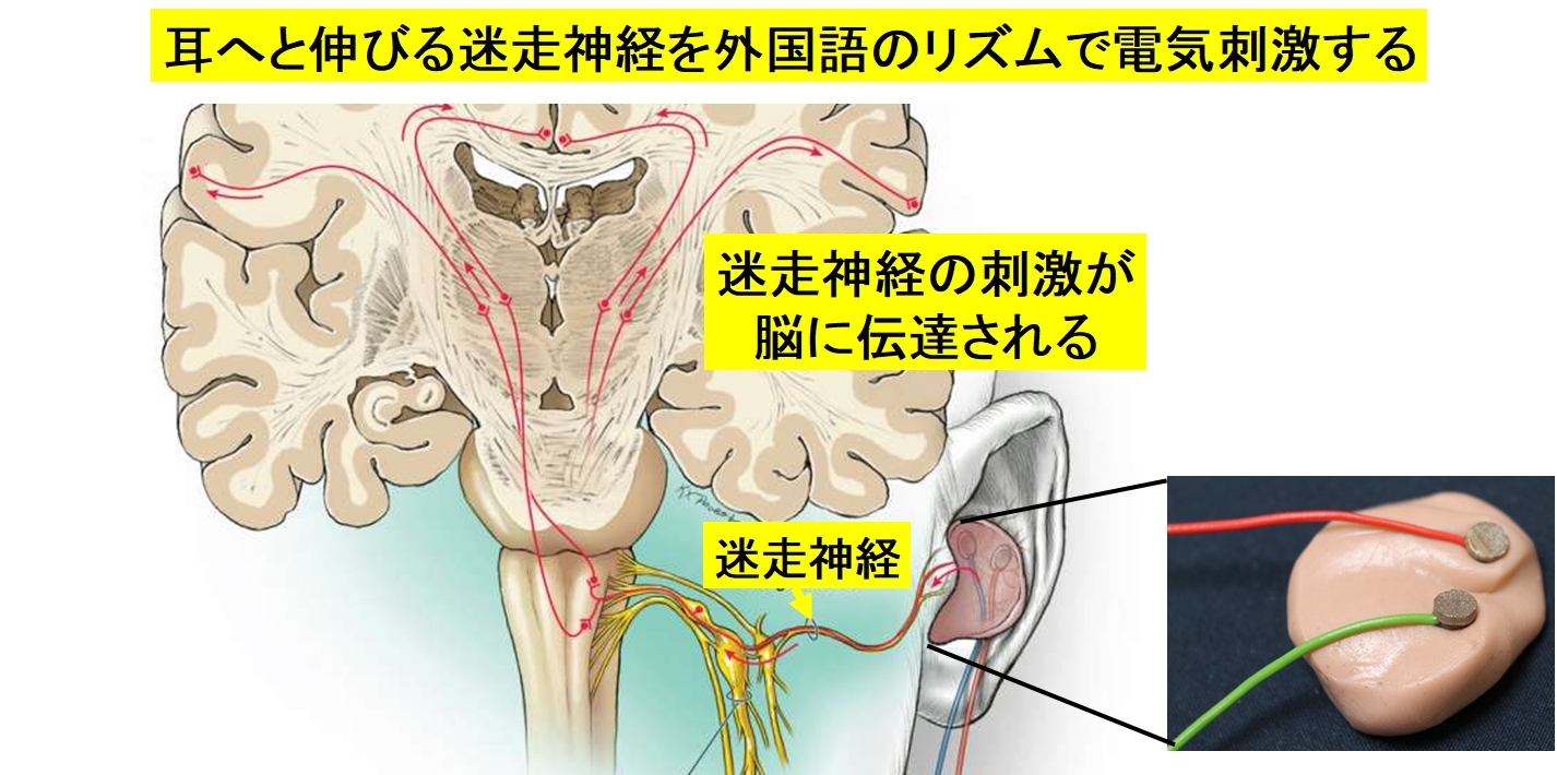 耳につけるだけで、外国語のリスニング能力が2倍になるウソみたいな装置。耳から「脳神経」を刺激するの画像 1/3