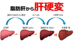 「1日4杯のコーヒー」は肝がんによる死亡リスクを70％少なくすると判明の画像 3/5