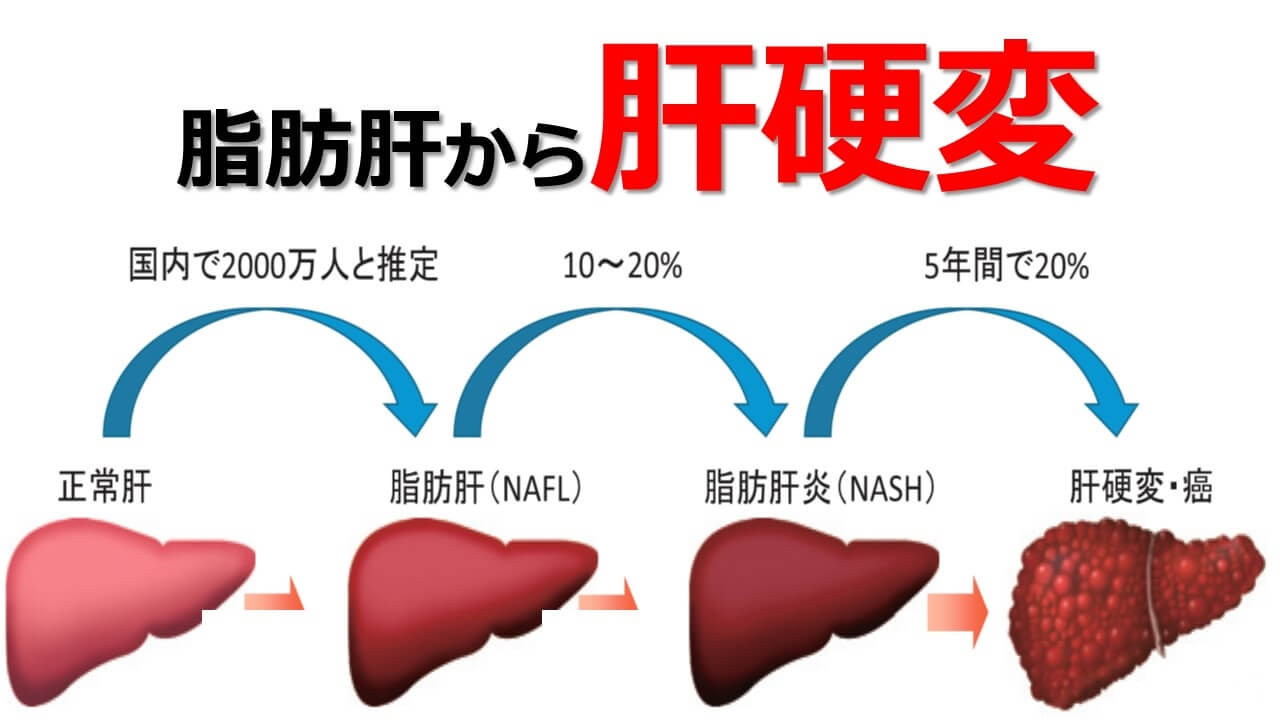 「1日4杯のコーヒー」は肝がんによる死亡リスクを70％少なくすると判明の画像 3/5