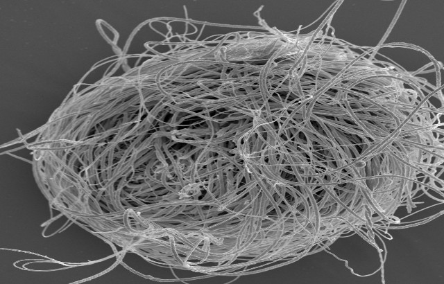 現代の貝形虫類の巨大な精子