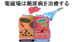 電磁場は糖尿病を治療する効果があった