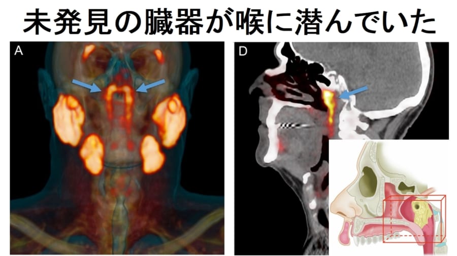 新たな臓器は第4の唾液腺だった