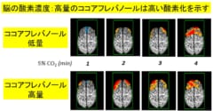 ココアフレバノールは脳の酸素化を助ける