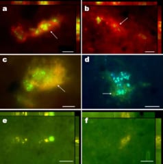 地下粘土サンプルから発見された細菌凝集体の蛍光顕微鏡画像。