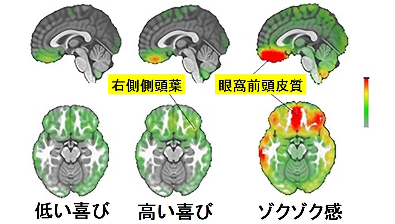 最も大きな変化がみられたのは前頭葉の一部だった