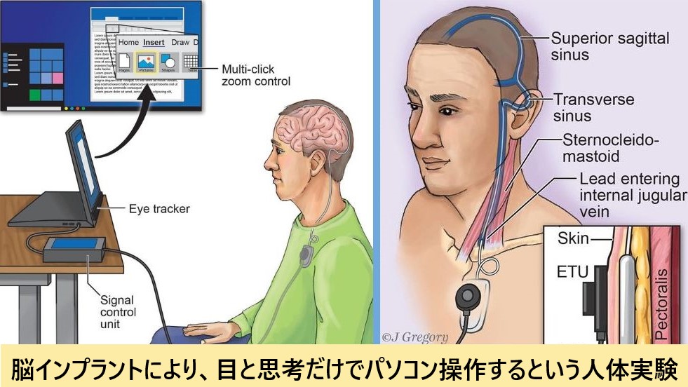 目と思考だけでパソコン操作できる