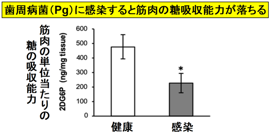 歯周病菌は筋肉が糖を取り込む力を落として糖尿病にする