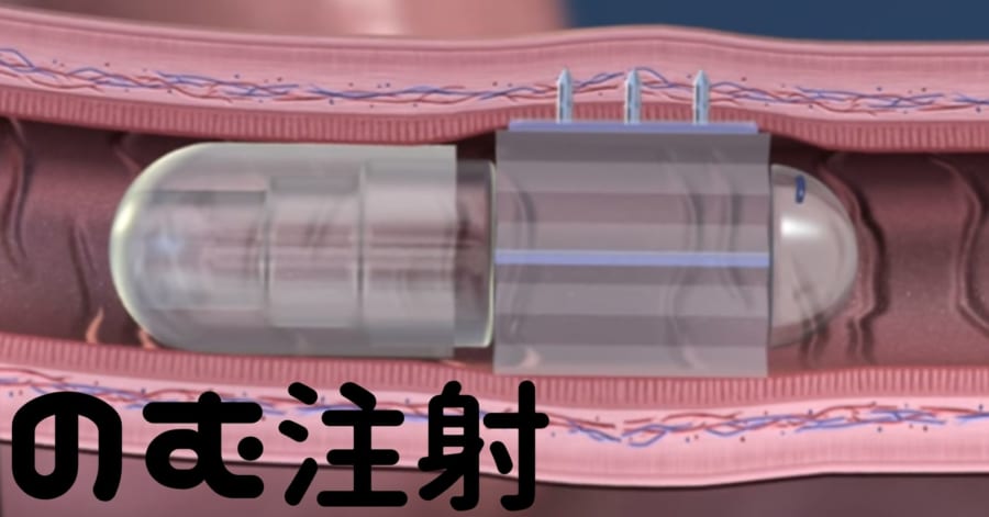 「のむ注射」がブスリと体内から薬を注入！ 未来の注射は痛くないかも