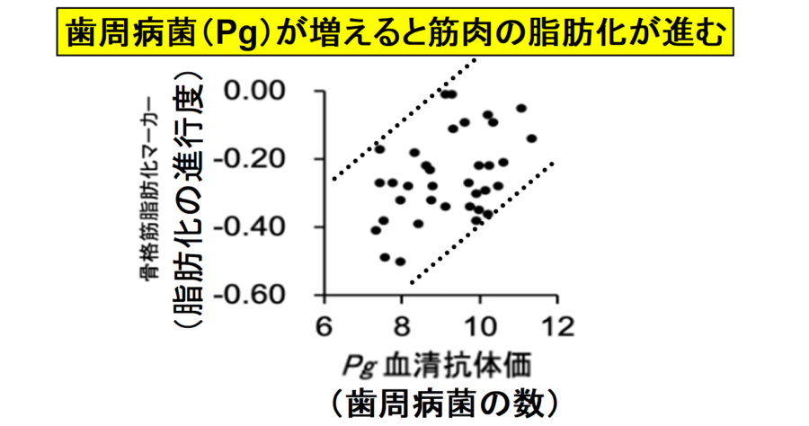 歯周病菌が筋肉を脂肪化してしまうと判明