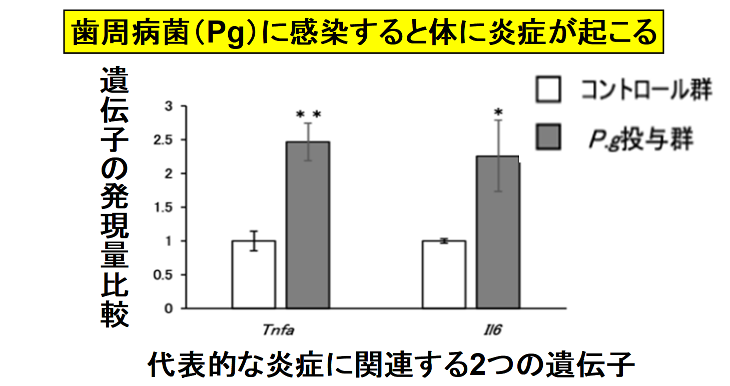 歯周病菌は体に炎症反応を引き起こす