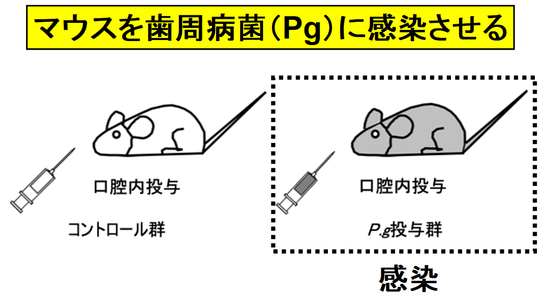 歯周病菌に感染したマウスは糖尿病になりやすくなる