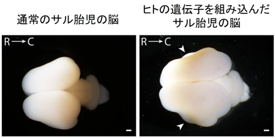 知恵の実のエキスであるヒトのARHGAP11B遺伝子を取り込んだサルの脳は巨大化した（100日齢）。矢印部分はシワの元