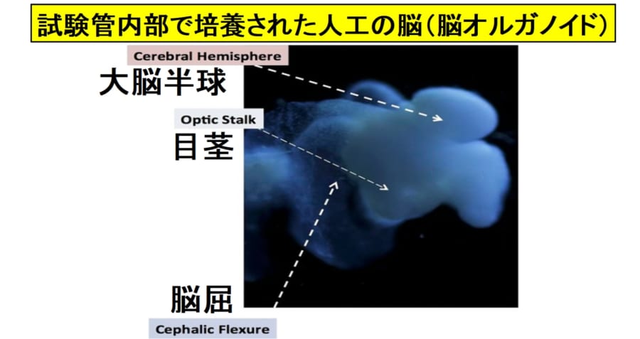 5週齢の胎児に似た消しゴムサイズの脳オルガノイド。上の飛び出ている部分が発達中の大脳半球