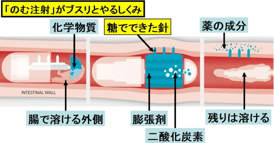 のむ注射のしくみ。二酸化炭素で膨張剤を膨らませて針を押し込む