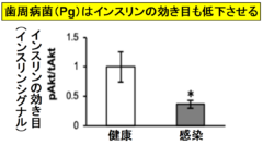 歯周病菌はインスリンの効き目も落とす