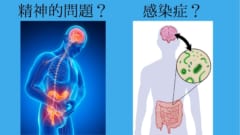 過敏性腸症候群の原因はずっと不明だった