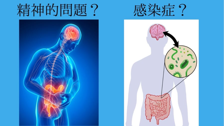 過敏性腸症候群の原因はずっと不明だった