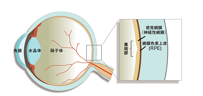 網膜色素上皮の位置